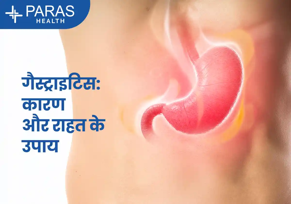 गैस्ट्राइटिस के लक्षण, कारण और इलाज